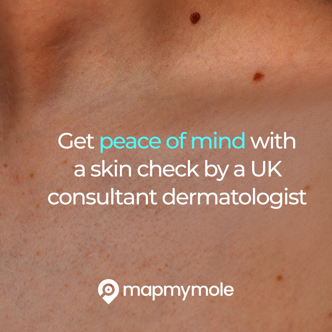 Map My Mole